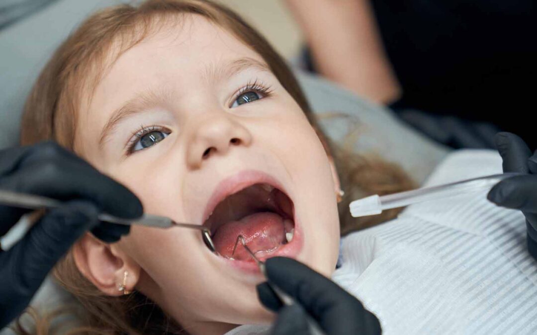 Cómo frenanr las caries infantil