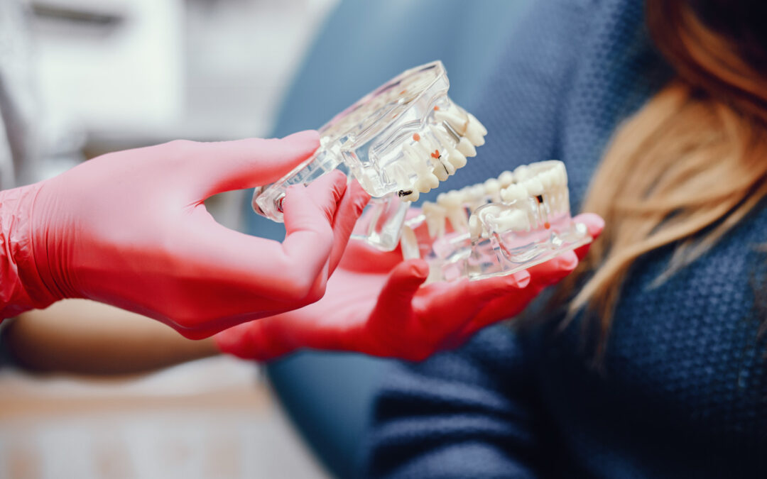 Proceso de osteointegración de un implante dental en el hueso, clínica Mundisalud Amurrio y Llodio