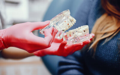 Qué es la osteointegración y por qué es clave en los implantes